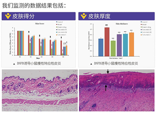 欧博ABG建设的特应性皮炎及湿疹模子监测数据效果