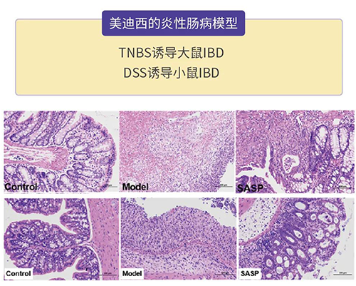 欧博ABG的炎症性肠病模子